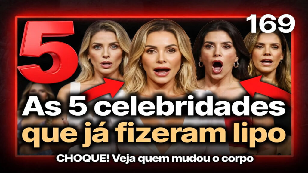 As 5 celebridades que já fizeram lipo