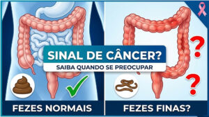 fezes finas