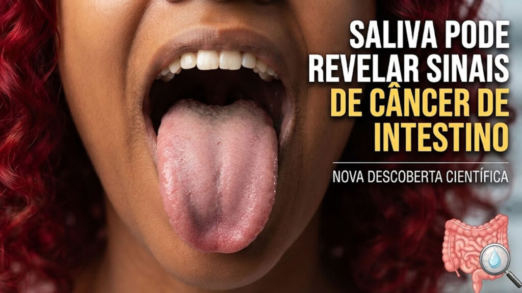 Saliva pode revelar sinais de câncer de intestino